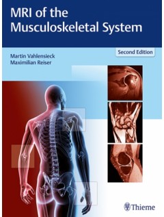 MRI of the Musculoskeletal System